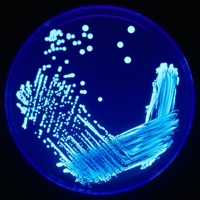 Legionella Case Occurs: 5 Recommended Next Steps